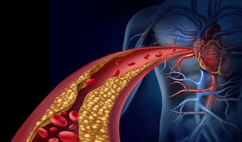 Природні способи підтримки здоров’я серцево-судинної системи