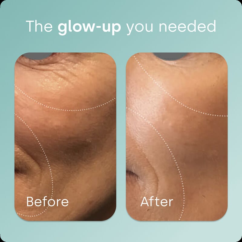 Advanced Collagen Generator®, 30 Cápsulas Originais
