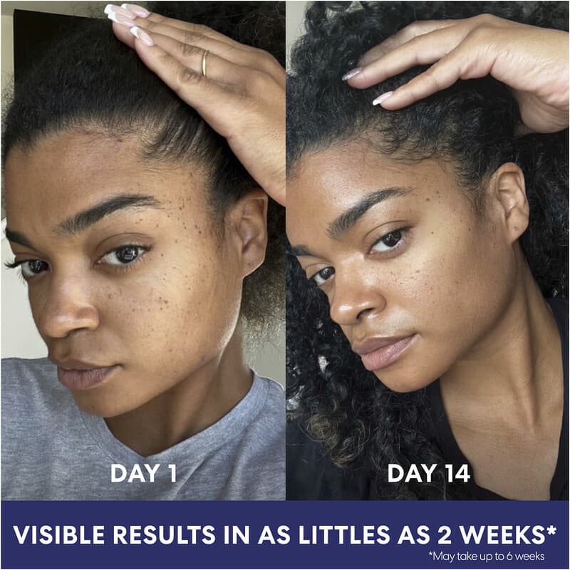 Skin Success With Vitamin E, Crema facial antimanchas, 75 g (2,7 oz)
