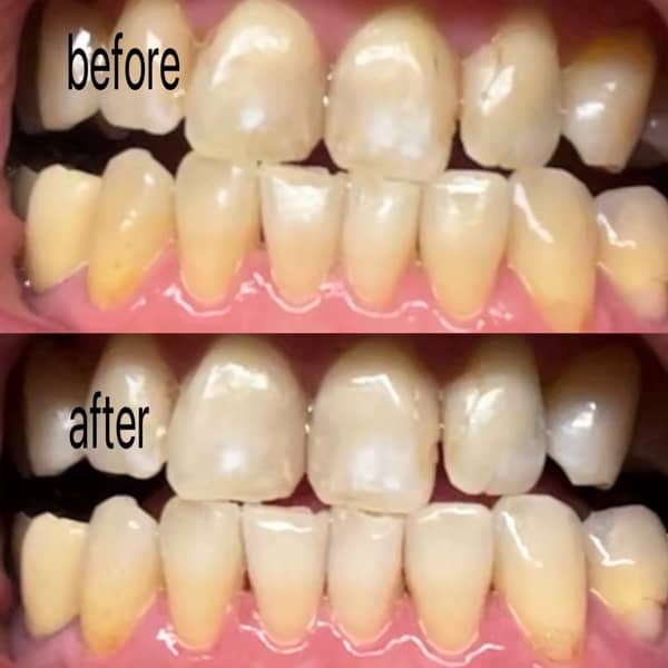 【タイムセール】クレスト　crest whitening クレスト3Dホワイトストリップスクラシックビビッド10回分(20枚