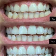 ページ 1 - レビュー - Crest（クレスト）, 3D Whitestrips（3D 